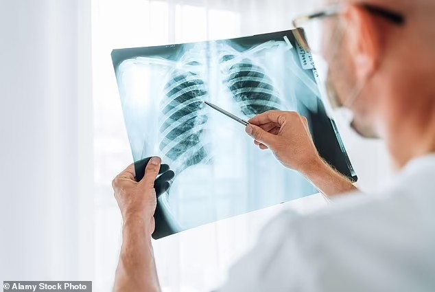 CXR Article image